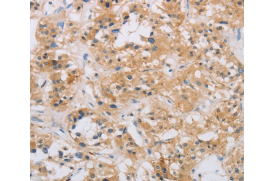 Immunohistochemistry - RAD54L2 Antibody from Signalway Antibody (35903) - Antibodies.com