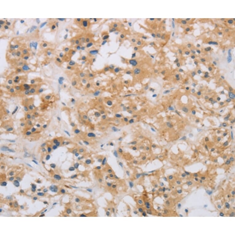 Immunohistochemistry - RAD54L2 Antibody from Signalway Antibody (35903) - Antibodies.com