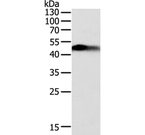 SLC12A1 Antibody from Signalway Antibody (35915) - Antibodies.com