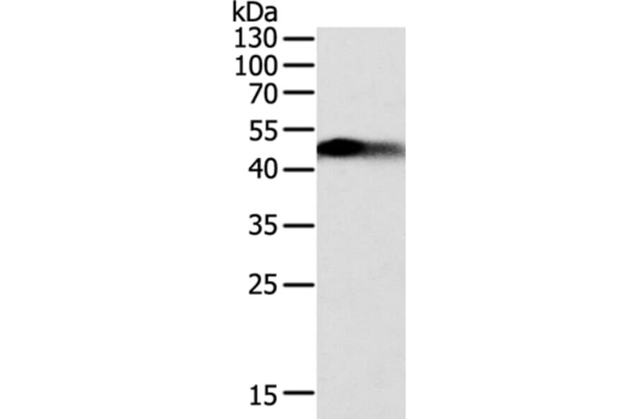 SLC12A1 Antibody from Signalway Antibody (35915) - Antibodies.com