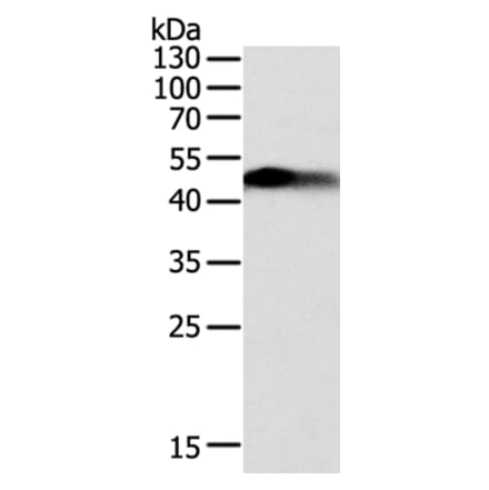 SLC12A1 Antibody from Signalway Antibody (35915) - Antibodies.com