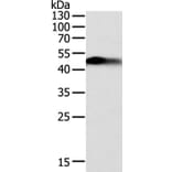 SLC12A1 Antibody from Signalway Antibody (35915) - Antibodies.com