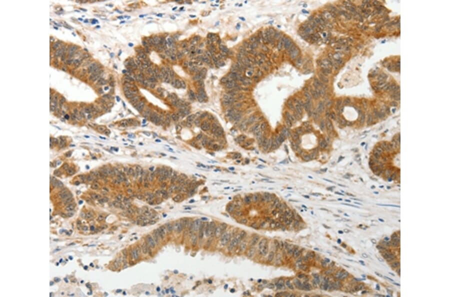 Immunohistochemistry - SLC12A1 Antibody from Signalway Antibody (35915) - Antibodies.com