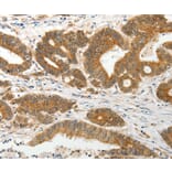 Immunohistochemistry - SLC12A1 Antibody from Signalway Antibody (35915) - Antibodies.com