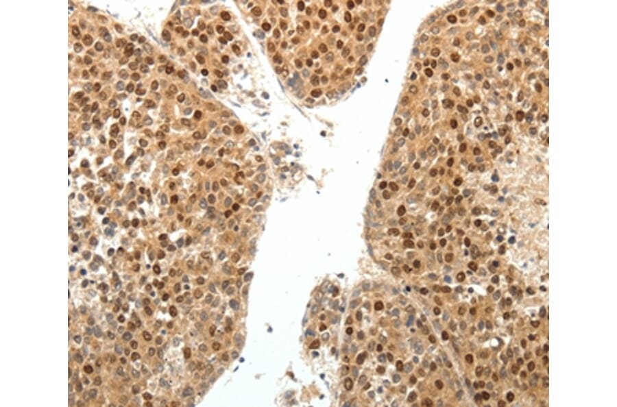 Immunohistochemistry - SPATA2L Antibody from Signalway Antibody (35941) - Antibodies.com