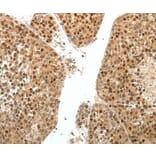 Immunohistochemistry - SPATA2L Antibody from Signalway Antibody (35941) - Antibodies.com