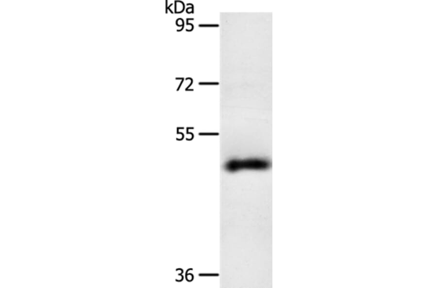 SPATA17 Antibody from Signalway Antibody (35943) - Antibodies.com