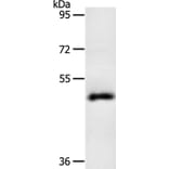 SPATA17 Antibody from Signalway Antibody (35943) - Antibodies.com