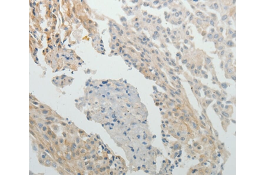 Immunohistochemistry - SPATA17 Antibody from Signalway Antibody (35943) - Antibodies.com