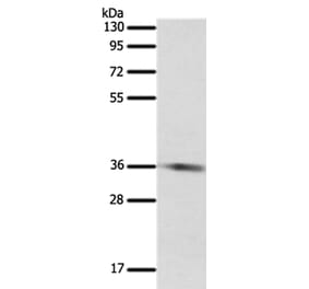 SULT1E1 Antibody from Signalway Antibody (35944) - Antibodies.com