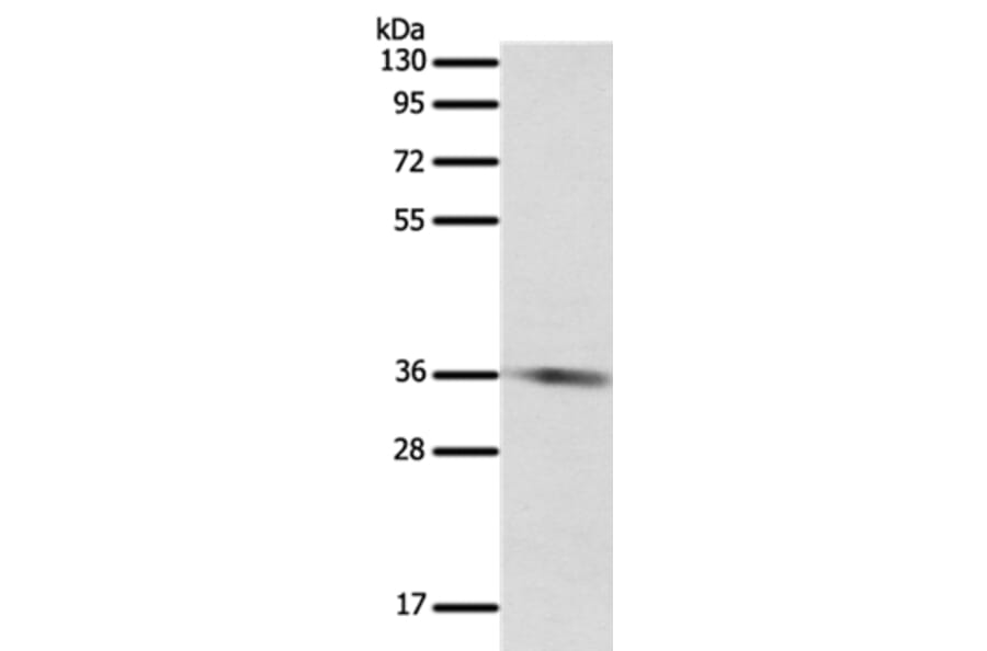 SULT1E1 Antibody from Signalway Antibody (35944) - Antibodies.com