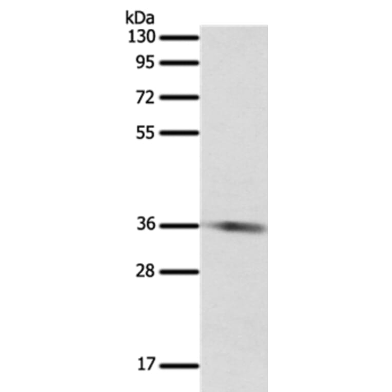 SULT1E1 Antibody from Signalway Antibody (35944) - Antibodies.com