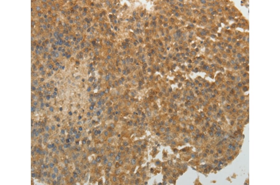 Immunohistochemistry - SULT1E1 Antibody from Signalway Antibody (35944) - Antibodies.com