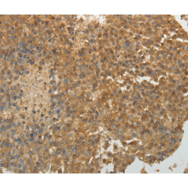 Immunohistochemistry - SULT1E1 Antibody from Signalway Antibody (35944) - Antibodies.com