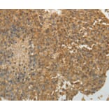 Immunohistochemistry - SULT1E1 Antibody from Signalway Antibody (35944) - Antibodies.com