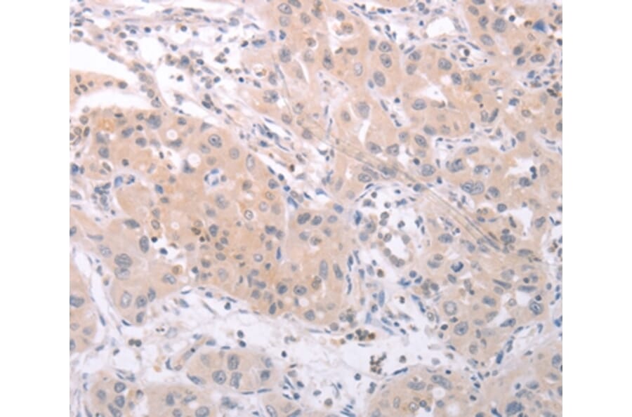 Immunohistochemistry - SPATA16 Antibody from Signalway Antibody (35979) - Antibodies.com