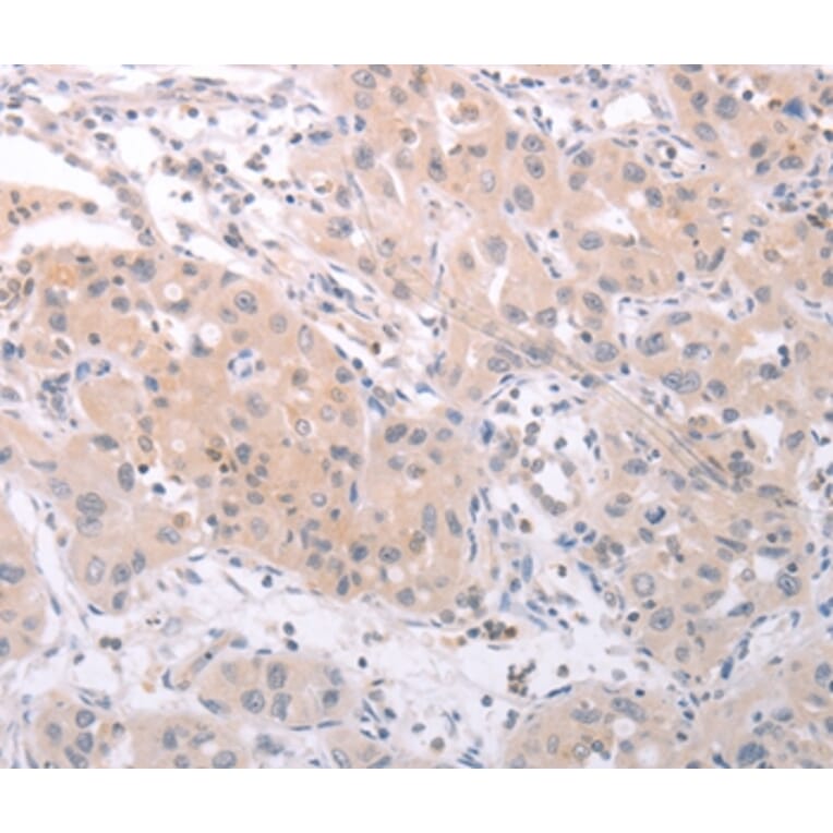 Immunohistochemistry - SPATA16 Antibody from Signalway Antibody (35979) - Antibodies.com