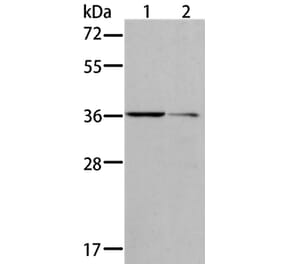 AKR1B10 Antibody from Signalway Antibody (36071) - Antibodies.com