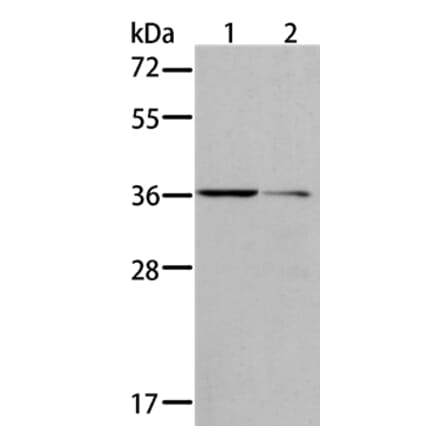 AKR1B10 Antibody from Signalway Antibody (36071) - Antibodies.com