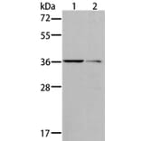 AKR1B10 Antibody from Signalway Antibody (36071) - Antibodies.com