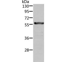 ALDH6A1 Antibody from Signalway Antibody (36077) - Antibodies.com