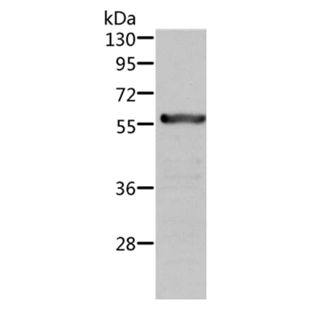 ALDH6A1 Antibody from Signalway Antibody (36077) - Antibodies.com
