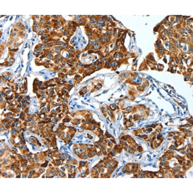 Immunohistochemistry - ALDH6A1 Antibody from Signalway Antibody (36077) - Antibodies.com