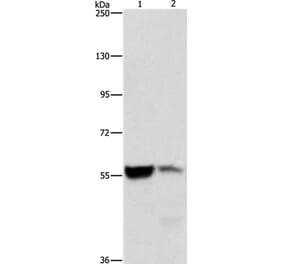 ALDH8A1 Antibody from Signalway Antibody (36078) - Antibodies.com