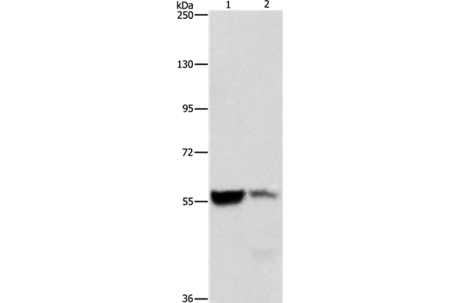ALDH8A1 Antibody from Signalway Antibody (36078) - Antibodies.com