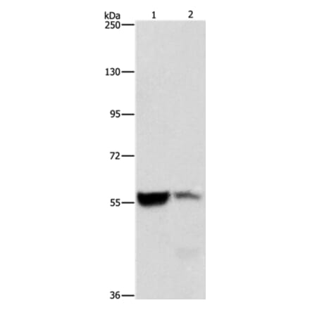 ALDH8A1 Antibody from Signalway Antibody (36078) - Antibodies.com