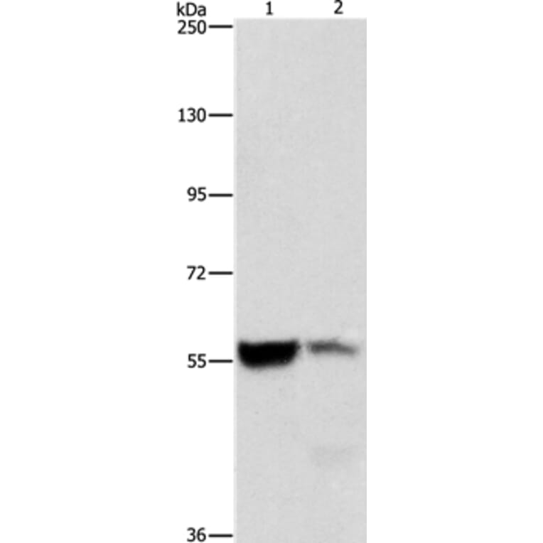 ALDH8A1 Antibody from Signalway Antibody (36078) - Antibodies.com