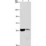 ALDH8A1 Antibody from Signalway Antibody (36078) - Antibodies.com