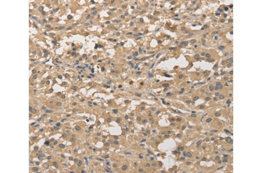 Immunohistochemistry - ALDH8A1 Antibody from Signalway Antibody (36078) - Antibodies.com
