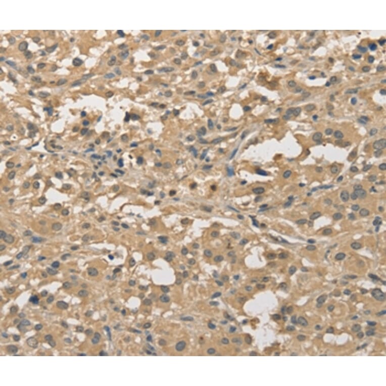 Immunohistochemistry - ALDH8A1 Antibody from Signalway Antibody (36078) - Antibodies.com