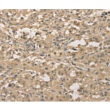 Immunohistochemistry - ALDH8A1 Antibody from Signalway Antibody (36078) - Antibodies.com