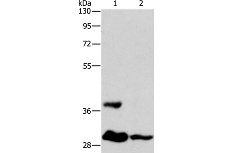 ANKRD54 Antibody from Signalway Antibody (36107) - Antibodies.com