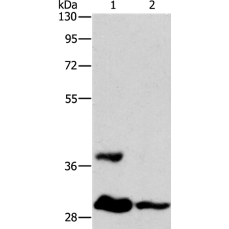 ANKRD54 Antibody from Signalway Antibody (36107) - Antibodies.com
