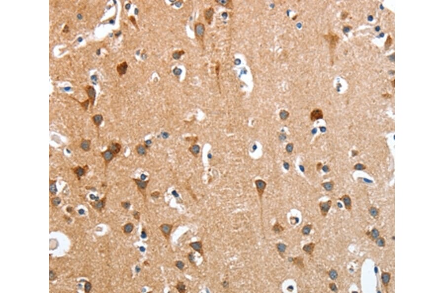 Immunohistochemistry - ANKRD54 Antibody from Signalway Antibody (36107) - Antibodies.com