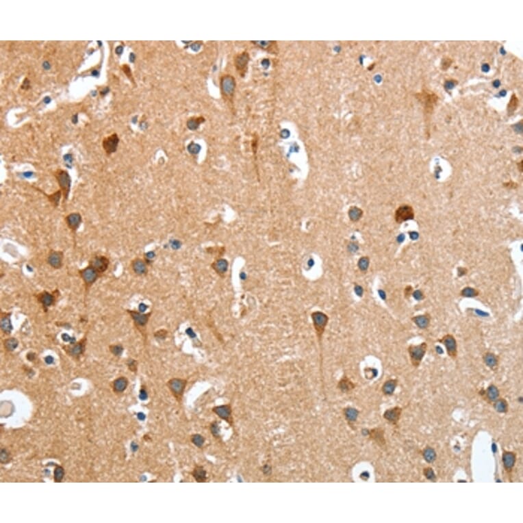 Immunohistochemistry - ANKRD54 Antibody from Signalway Antibody (36107) - Antibodies.com