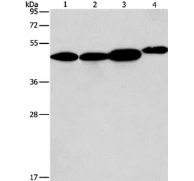 ARFGAP1 Antibody from Signalway Antibody (36127) - Antibodies.com