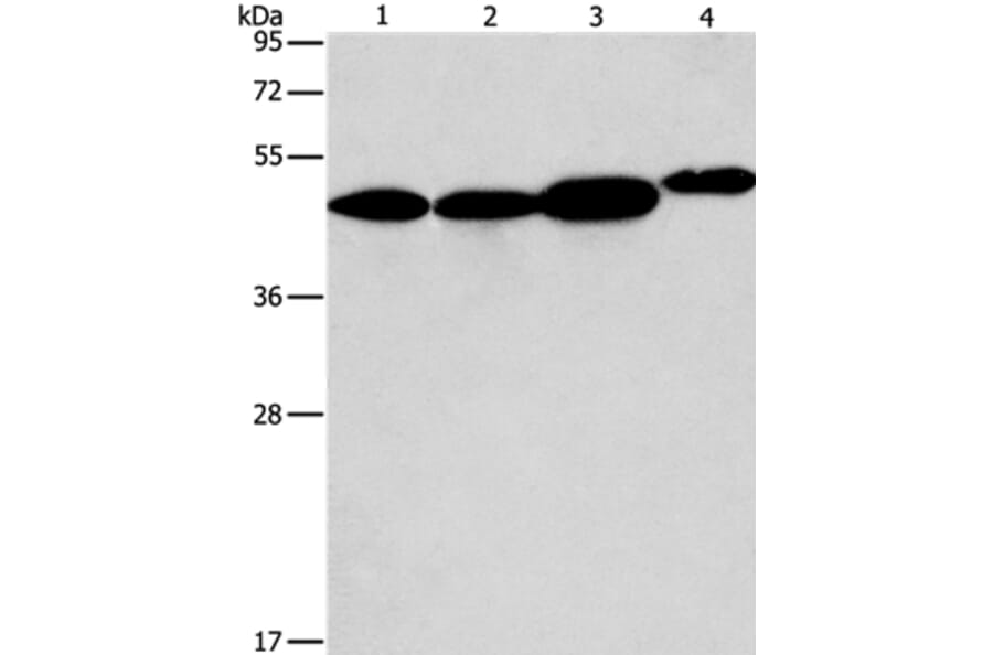ARFGAP1 Antibody from Signalway Antibody (36127) - Antibodies.com