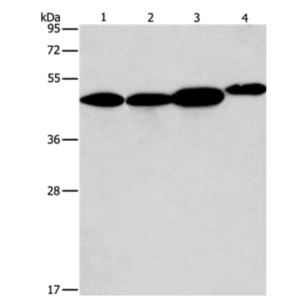 ARFGAP1 Antibody from Signalway Antibody (36127) - Antibodies.com