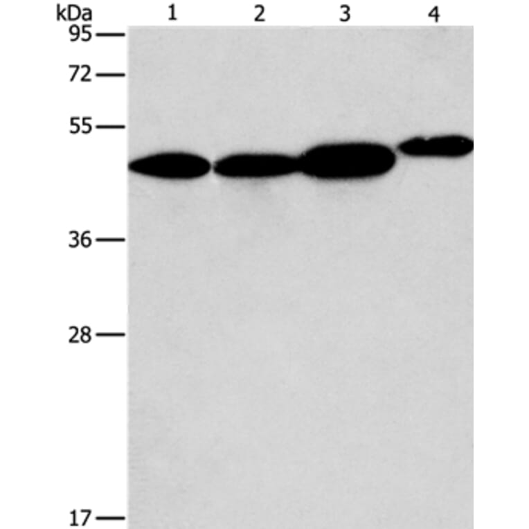 ARFGAP1 Antibody from Signalway Antibody (36127) - Antibodies.com