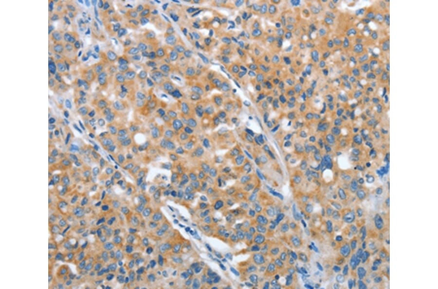 Immunohistochemistry - ARFGAP1 Antibody from Signalway Antibody (36127) - Antibodies.com
