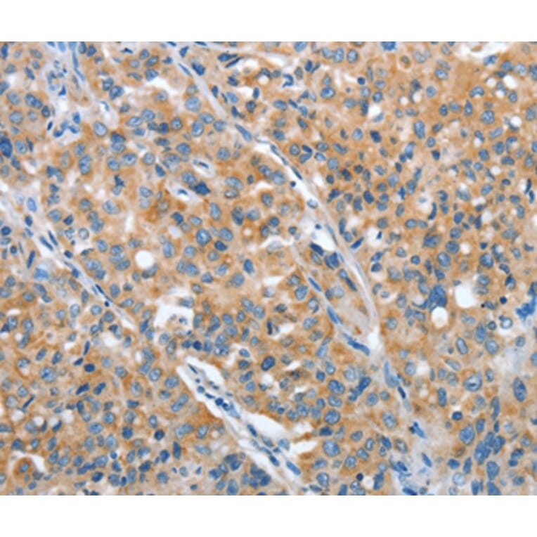 Immunohistochemistry - ARFGAP1 Antibody from Signalway Antibody (36127) - Antibodies.com