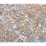 Immunohistochemistry - ARFGAP1 Antibody from Signalway Antibody (36127) - Antibodies.com
