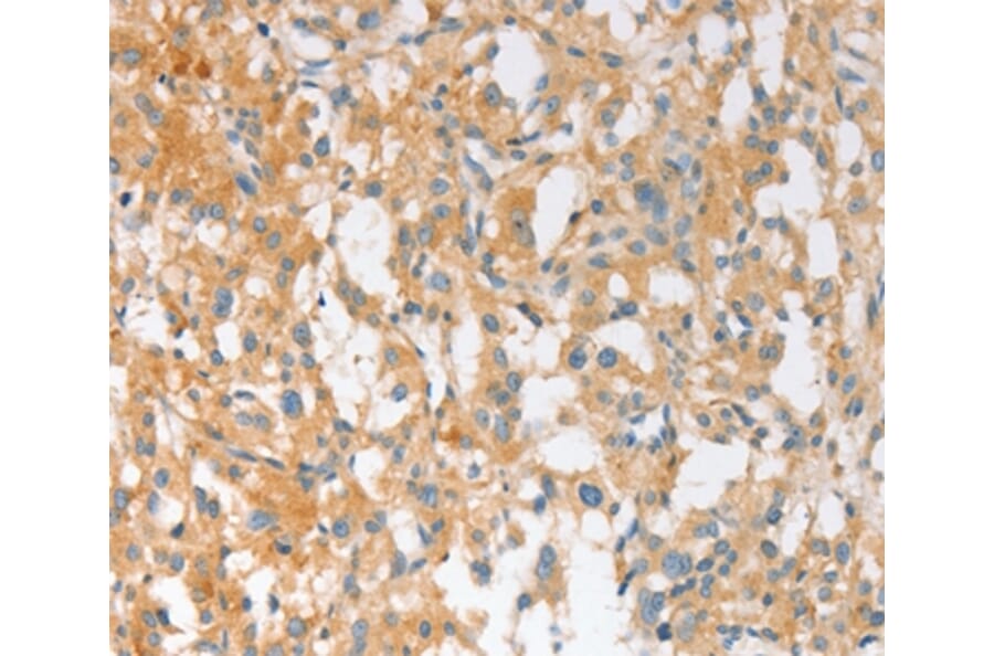 Immunohistochemistry - EPS15L1 Antibody from Signalway Antibody (36170) - Antibodies.com