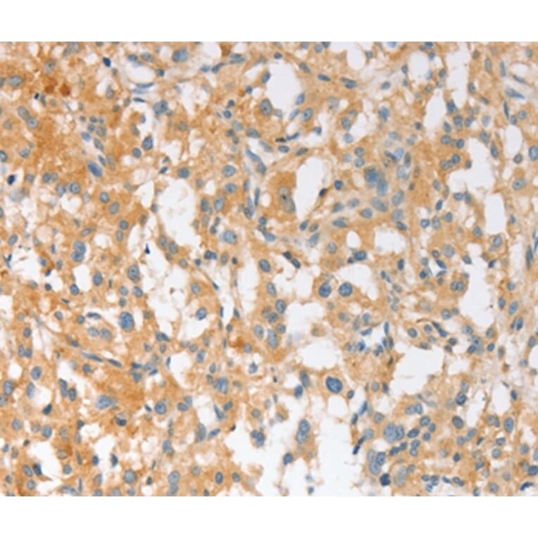 Immunohistochemistry - EPS15L1 Antibody from Signalway Antibody (36170) - Antibodies.com