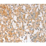 Immunohistochemistry - EPS15L1 Antibody from Signalway Antibody (36170) - Antibodies.com