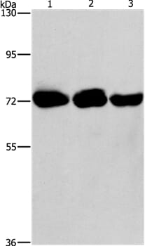 Gel: 6%SDS-PAGE Lysates (from left to right): Hela, A431 and 293T cell Amount of lysate: 40ug per lane Primary antibody: 1/260 dilution Secondary antibody dilution: 1/8000 Exposure time: 30 seconds